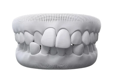 teeth thumb01